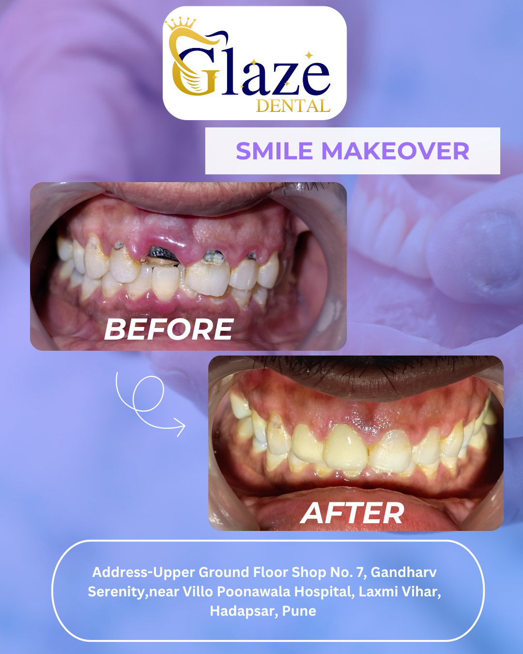 Glaze Dental Clinic - Speciality Dental Clinic and Implant Centre - 1567