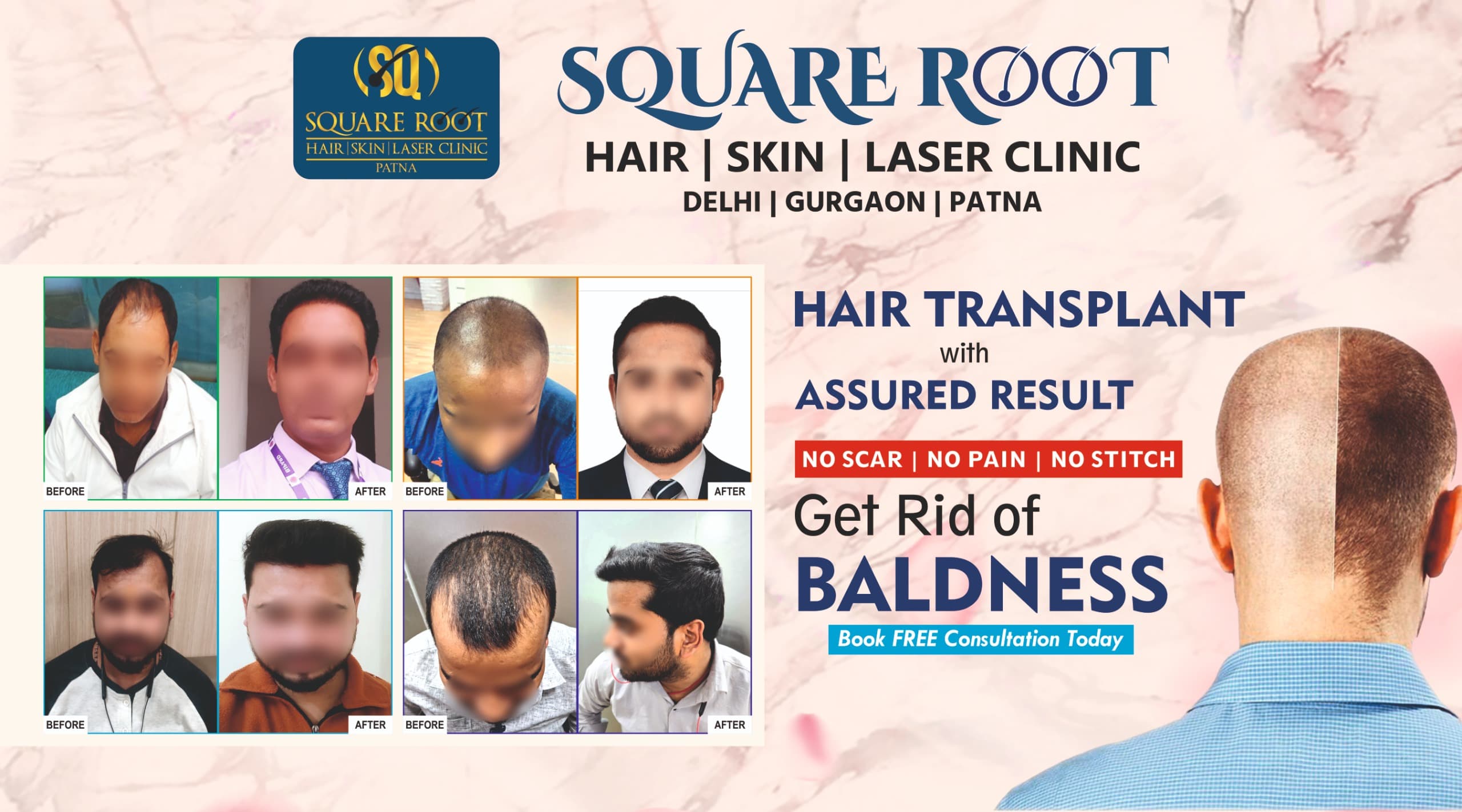 Square Root : Hair | Skin | Laser Clinic - 680