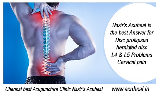 Chennai Best Acupuncture Clinic in OMR Padur - 234