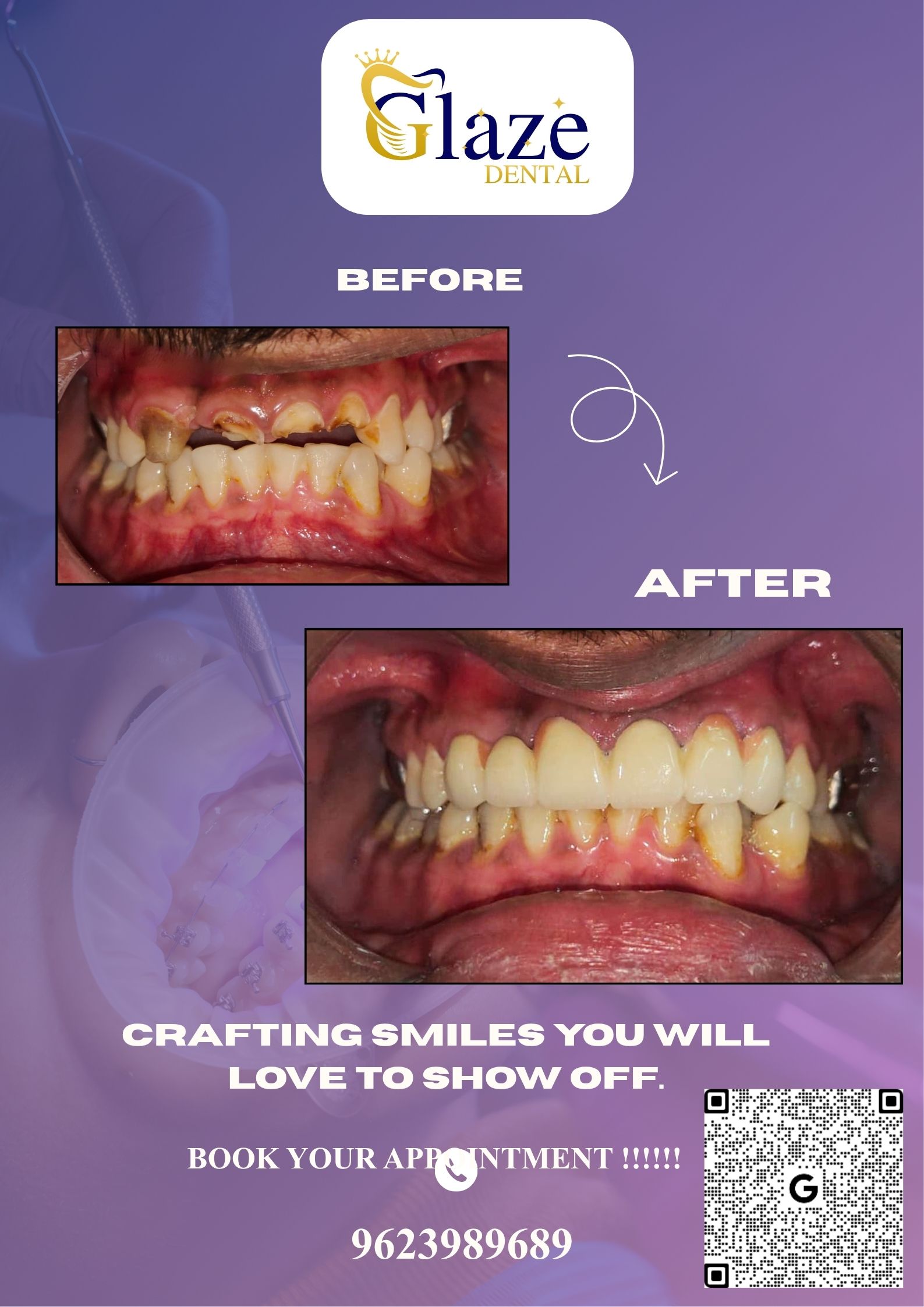 Glaze Dental Clinic - Speciality Dental Clinic and Implant Centre - 1566