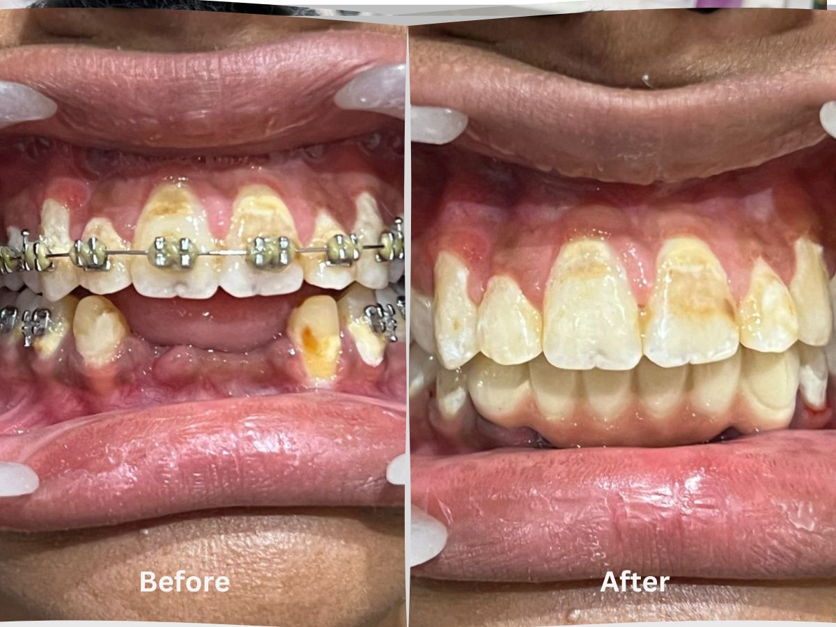 Sarvadnya Advance Dental Care Best Dentist in Aurangabad - 1773