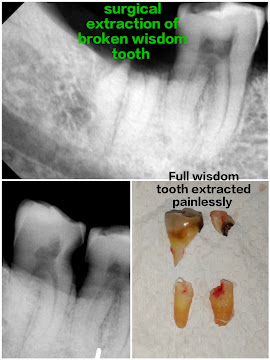 Raj Dental And Implant Expert - 1936