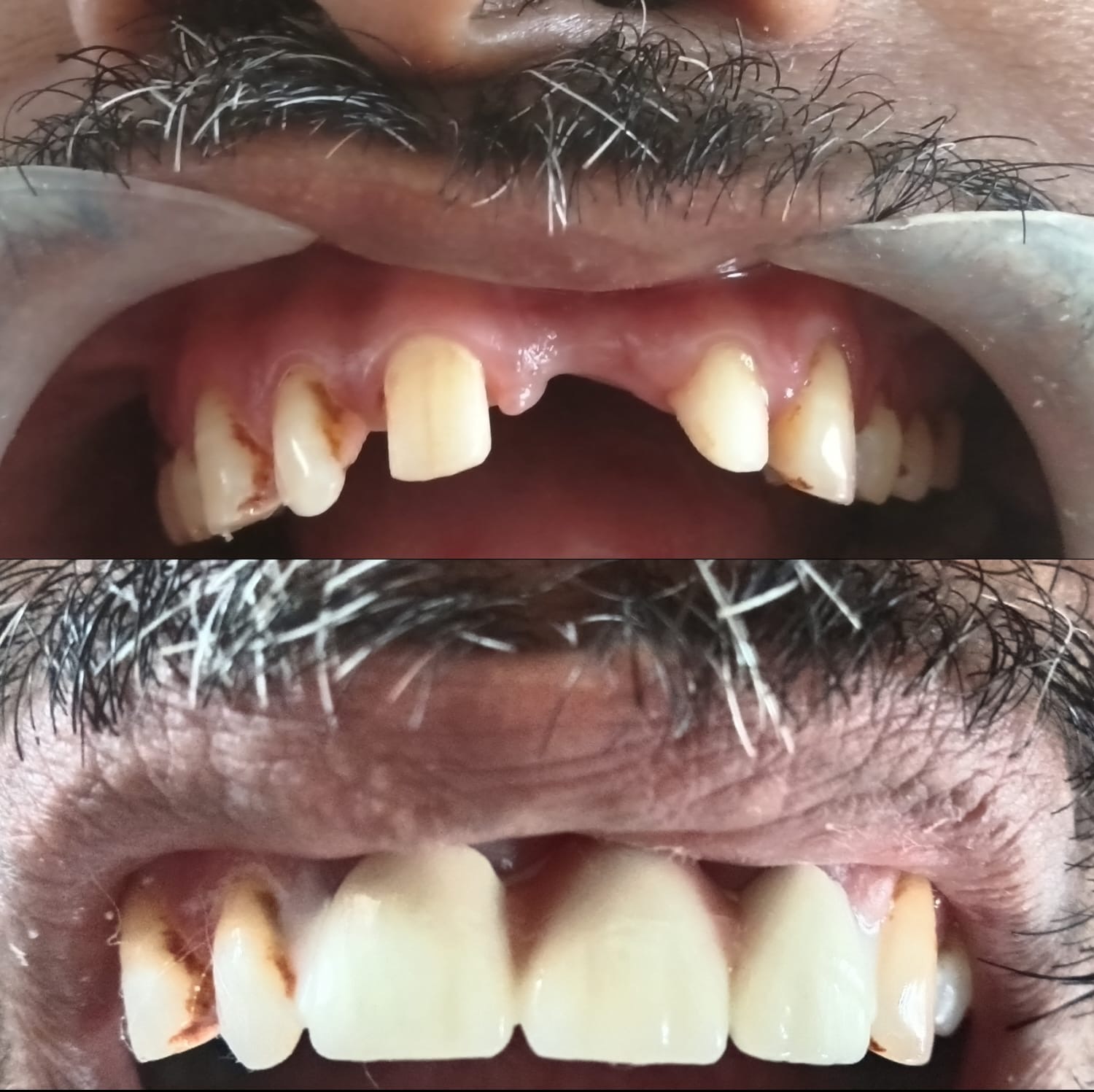 Dr shukal brothers dental clinic photo 4