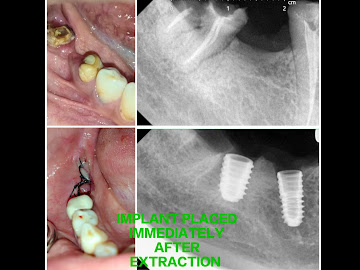 Raj Dental And Implant Expert - 1938