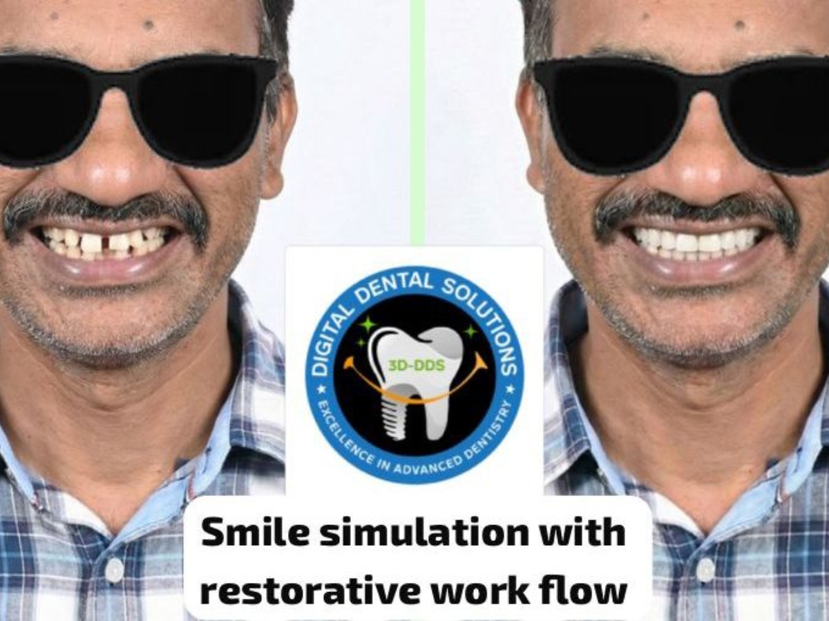 3D-DDS (Digital Dental Solutions) - 1741